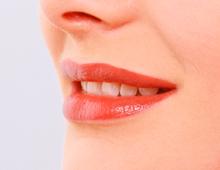 ホワイトニング